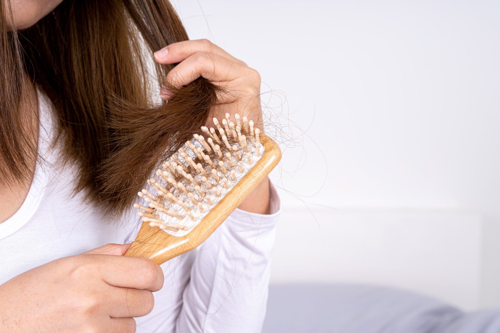 Kóros hajhullás hajritkulás kopaszodás bőrgyógyászati hátterének vizsgálata és kezelése