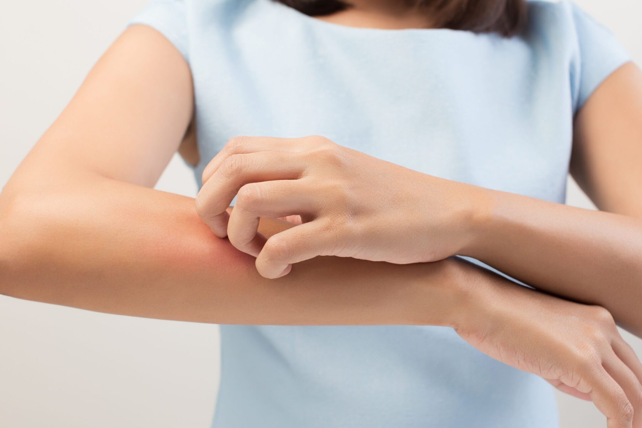 Krónikus bőrbetegségek (pikkelysömör ekcéma atopia) vizsgálata és kezelése