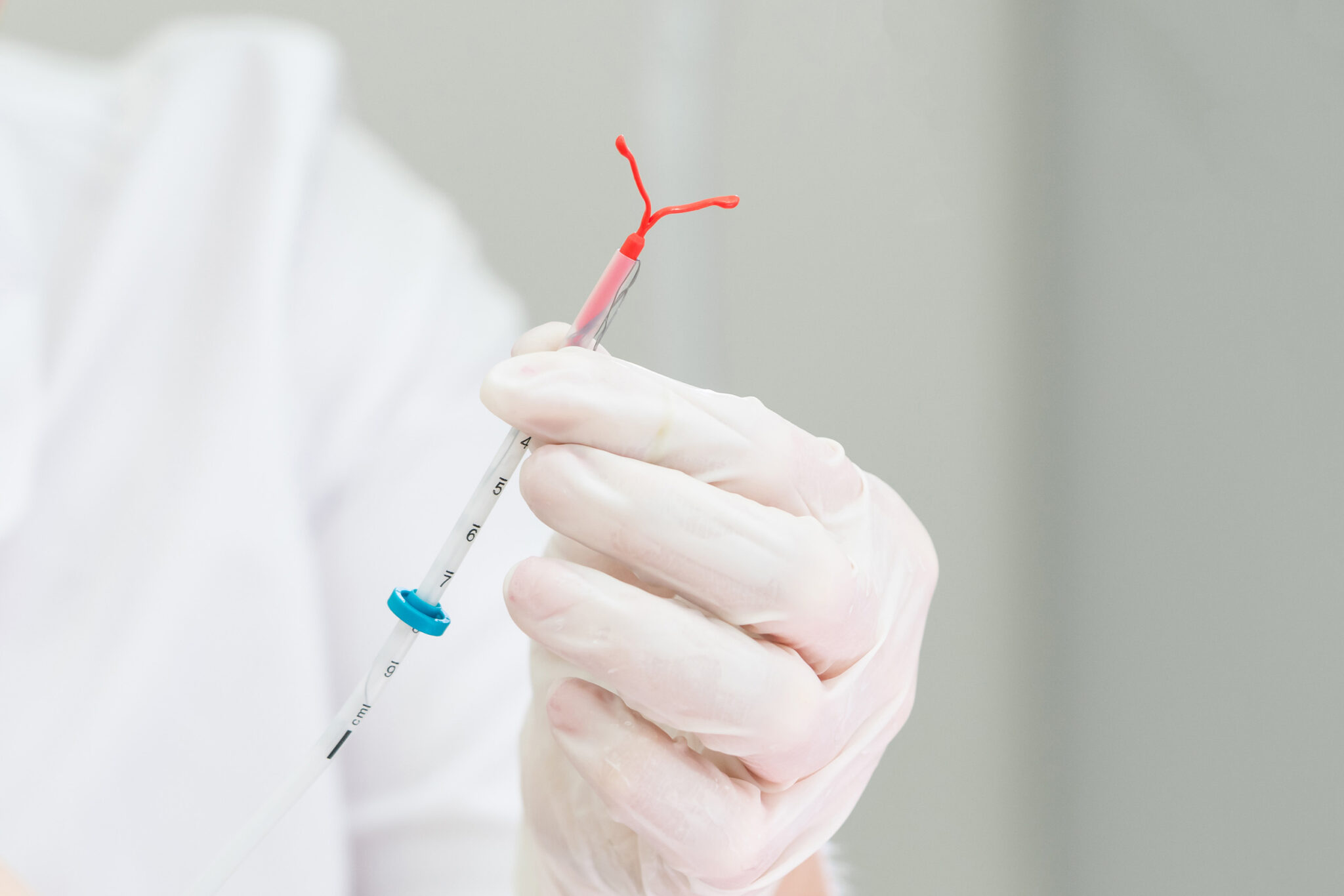 IUD felhelyezés