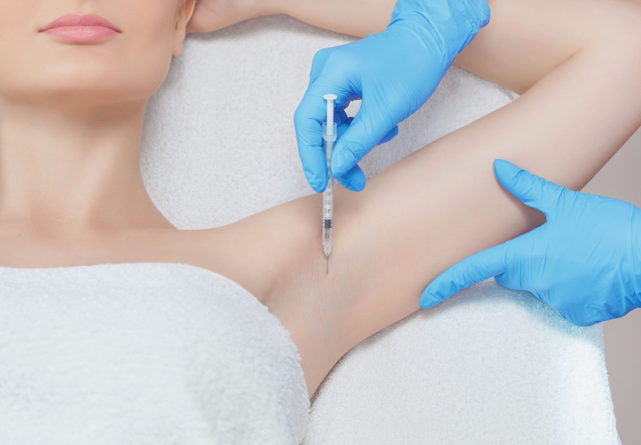 Hónalj, tenyér, talp izzadás kezelése botulinum toxinnal